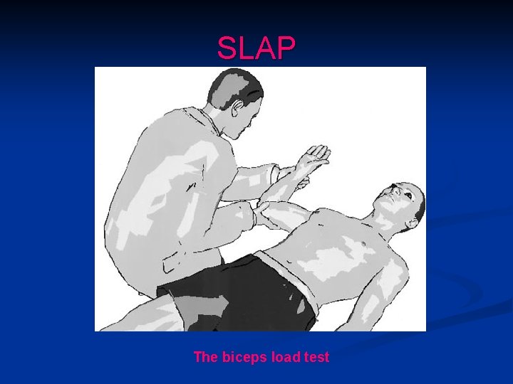 SLAP The biceps load test 