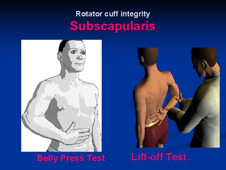 Rotator cuff integrity Subscapularis Belly Press Test Lift-off Test 