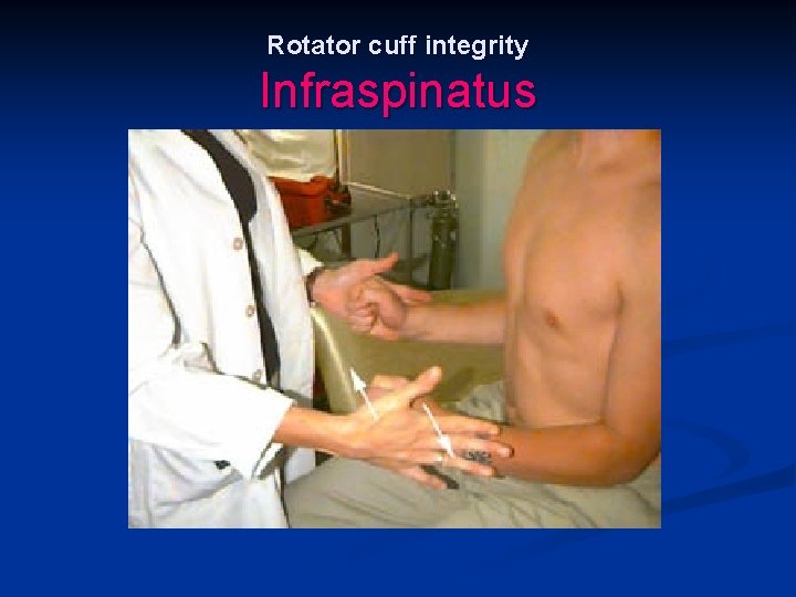 Rotator cuff integrity Infraspinatus 
