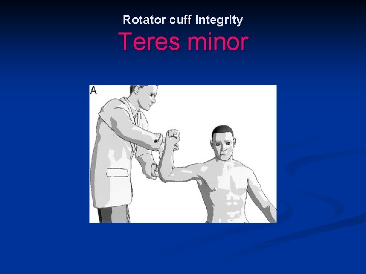 Rotator cuff integrity Teres minor 