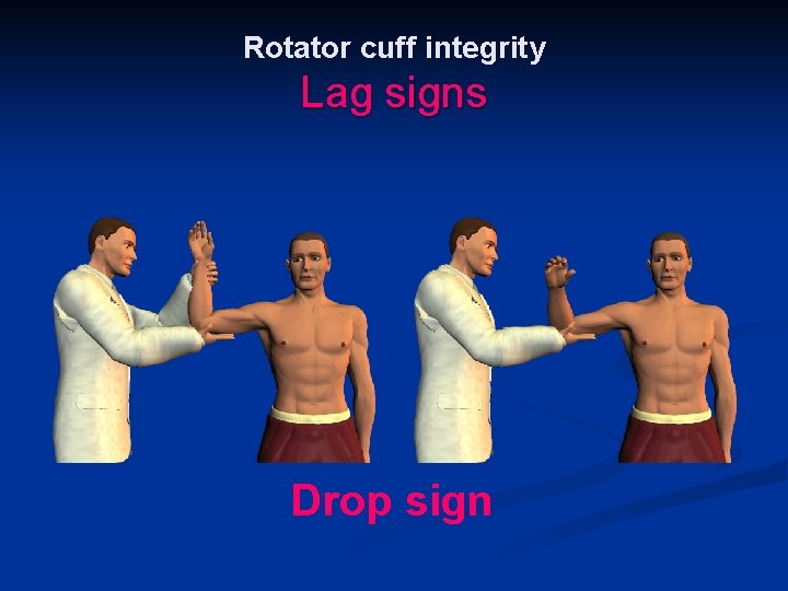 Rotator cuff integrity Lag signs Drop sign 