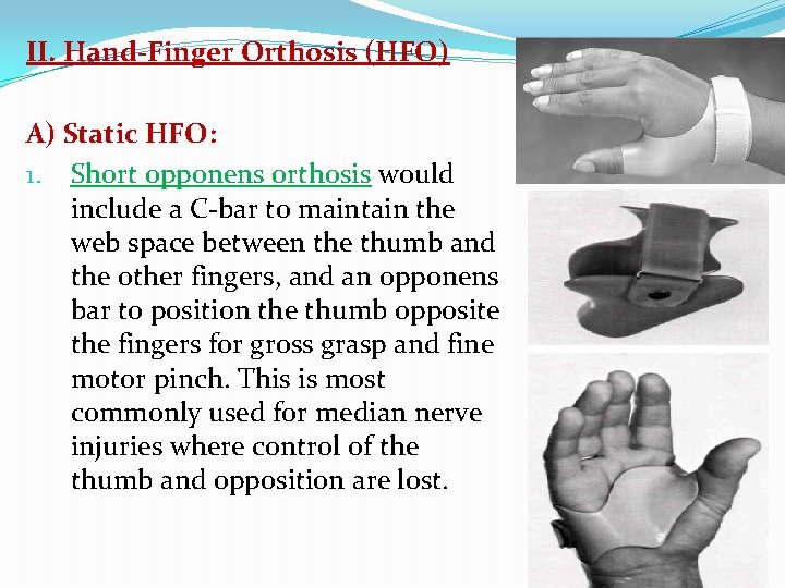 II. Hand-Finger Orthosis (HFO) A) Static HFO: 1. Short opponens orthosis would include a