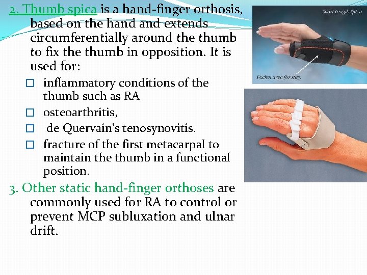2. Thumb spica is a hand-finger orthosis, based on the hand extends circumferentially around