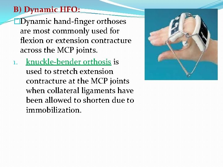 B) Dynamic HFO: �Dynamic hand-finger orthoses are most commonly used for flexion or extension