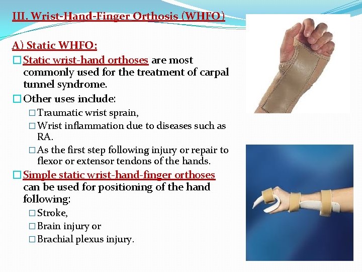 III. Wrist-Hand-Finger Orthosis (WHFO) A) Static WHFO: �Static wrist-hand orthoses are most commonly used
