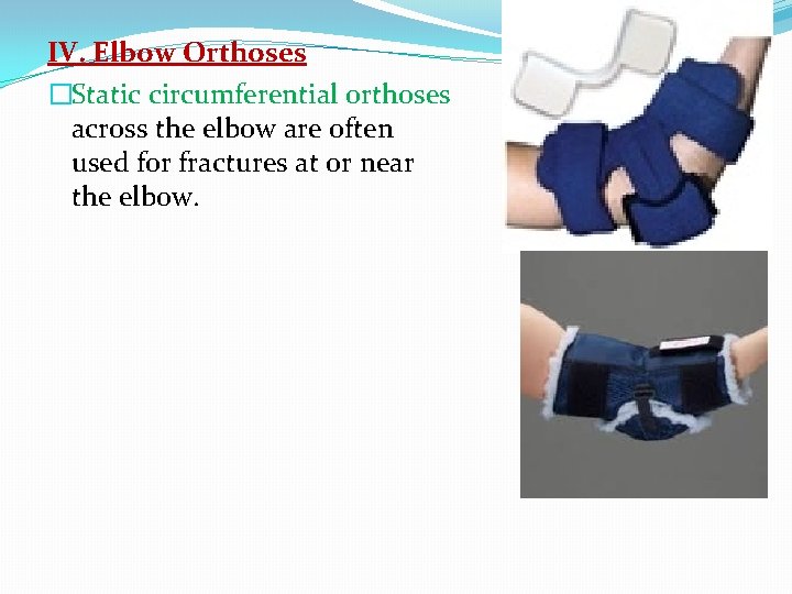 IV. Elbow Orthoses �Static circumferential orthoses across the elbow are often used for fractures
