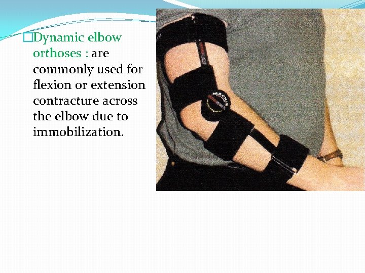�Dynamic elbow orthoses : are commonly used for flexion or extension contracture across the