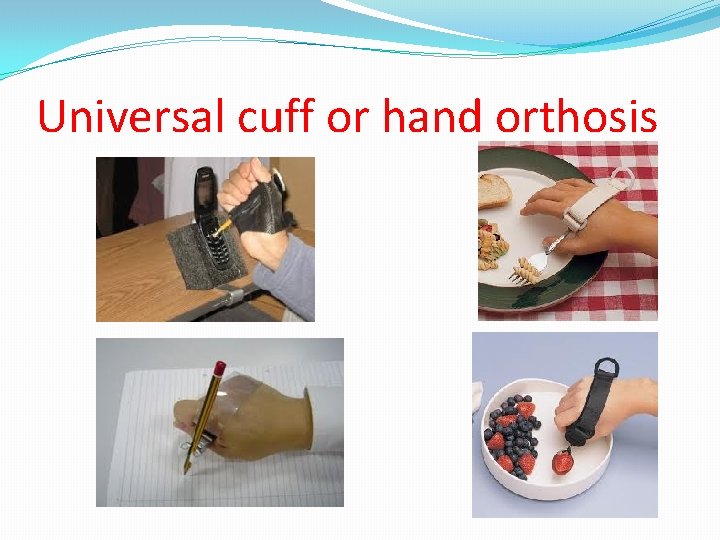 Universal cuff or hand orthosis 