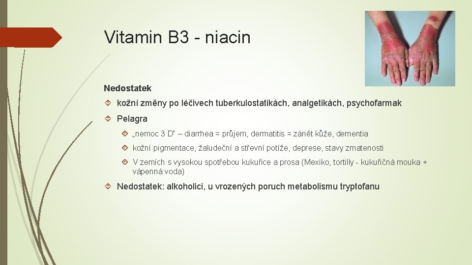 Vitamin B 3 - niacin Nedostatek kožní změny po léčivech tuberkulostatikách, analgetikách, psychofarmak Pelagra