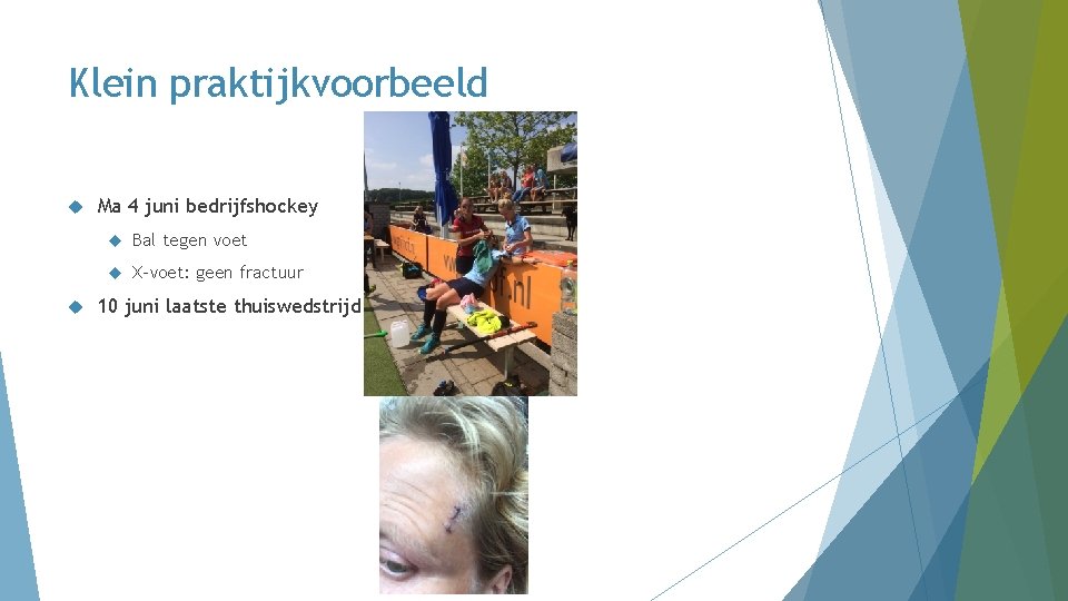 Klein praktijkvoorbeeld Ma 4 juni bedrijfshockey Bal tegen voet X-voet: geen fractuur 10 juni Klein praktijkvoorbeeld Ma 4 juni bedrijfshockey Bal tegen voet X-voet: geen fractuur 10 juni