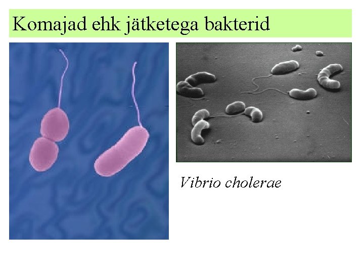 Komajad ehk jätketega bakterid Vibrio cholerae 