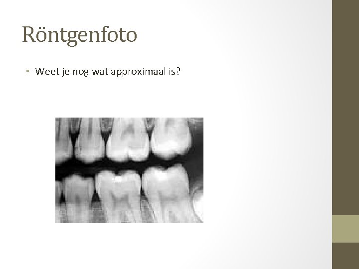 Röntgenfoto • Weet je nog wat approximaal is? 