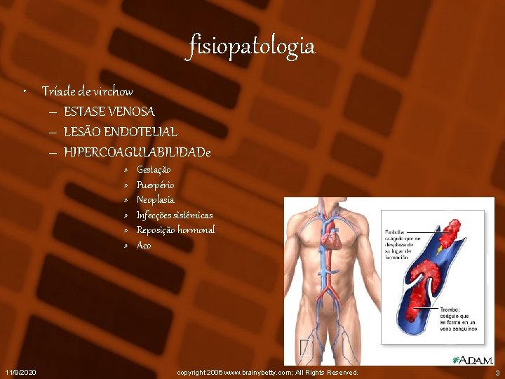 fisiopatologia • Tríade de virchow – ESTASE VENOSA – LESÃO ENDOTELIAL – HIPERCOAGULABILIDADe »