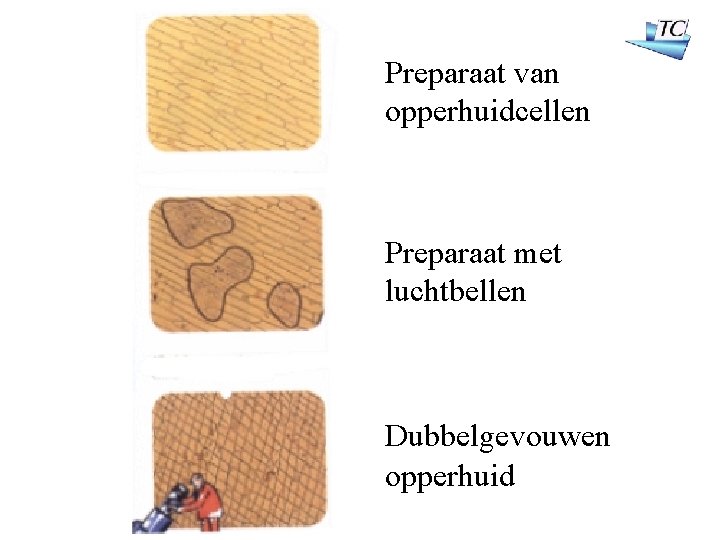 Preparaat van opperhuidcellen Preparaat met luchtbellen Dubbelgevouwen opperhuid 