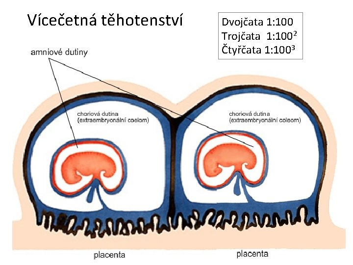 Vícečetná těhotenství Dvojčata 1: 100 Trojčata 1: 1002 Čtyřčata 1: 1003 