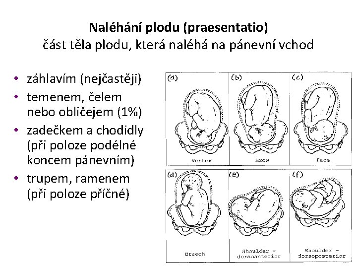 Naléhání plodu (praesentatio) část těla plodu, která naléhá na pánevní vchod • záhlavím (nejčastěji)