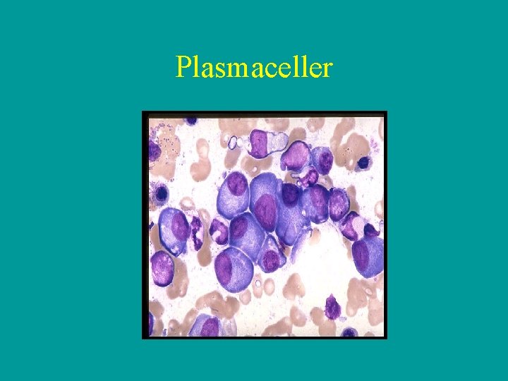 Plasmaceller 