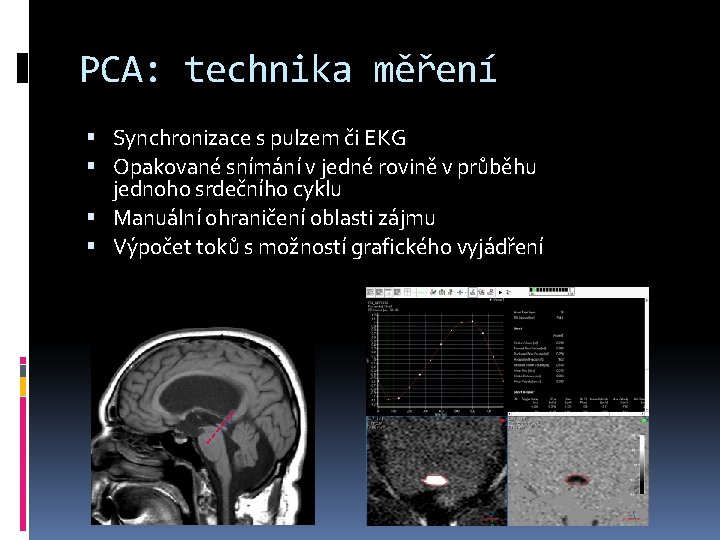 PCA: technika měření Synchronizace s pulzem či EKG Opakované snímání v jedné rovině v