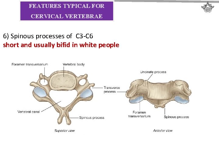 FEATURES TYPICAL FOR CERVICAL VERTEBRAE 6) Spinous processes of C 3 -C 6 short