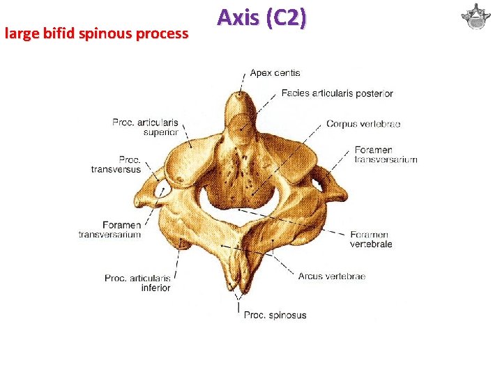 large bifid spinous process Axis (C 2) 