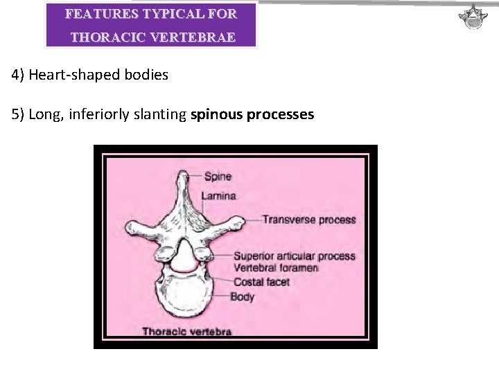 FEATURES TYPICAL FOR THORACIC VERTEBRAE 4) Heart-shaped bodies 5) Long, inferiorly slanting spinous processes