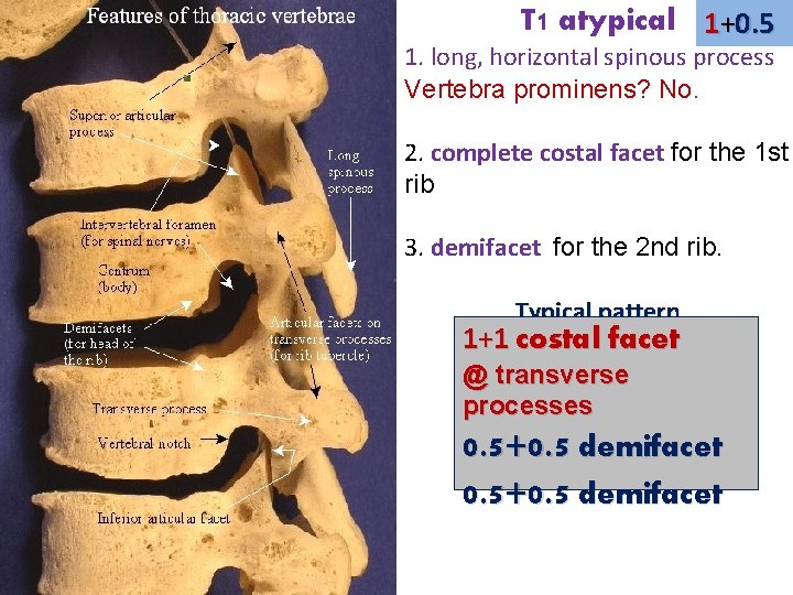 T 1 atypical 1+0. 5 1. long, horizontal spinous process Vertebra prominens? No. 2.