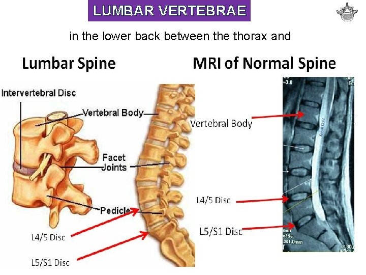 LUMBAR VERTEBRAE in the lower back between the thorax and sacrum 