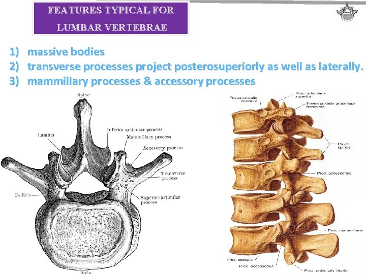 FEATURES TYPICAL FOR LUMBAR VERTEBRAE 1) massive bodies 2) transverse processes project posterosuperiorly as