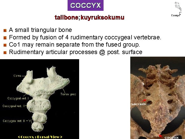 COCCYX tailbone; kuyruksokumu A small triangular bone Formed by fusion of 4 rudimentary coccygeal