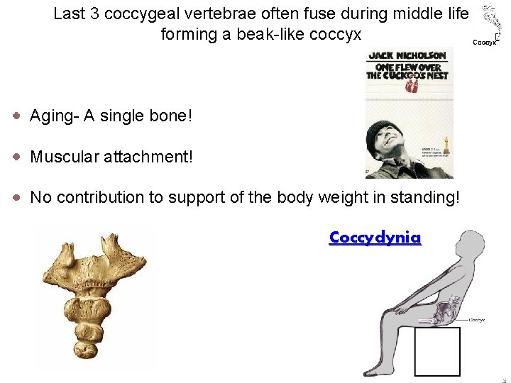 Last 3 coccygeal vertebrae often fuse during middle life forming a beak-like coccyx Aging-