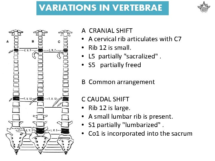 VARIATIONS IN VERTEBRAE A • • CRANIAL SHIFT A cervical rib articulates with C