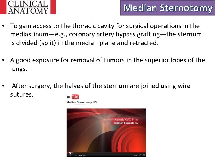 Median Sternotomy • To gain access to the thoracic cavity for surgical operations in