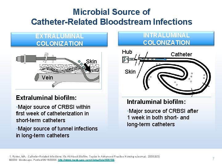 Microbial Source of Catheter-Related Bloodstream Infections INTRALUMINAL COLONIZATION EXTRALUMINAL COLONIZATION Hub Catheter Skin Vein