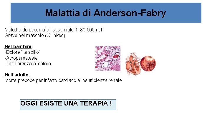 Malattia di Anderson-Fabry Malattia da accumulo lisosomiale 1: 80. 000 nati Grave nel maschio