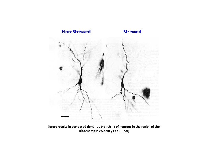 Non-Stressed Stress results in decreased dendritic branching of neurons in the region of the