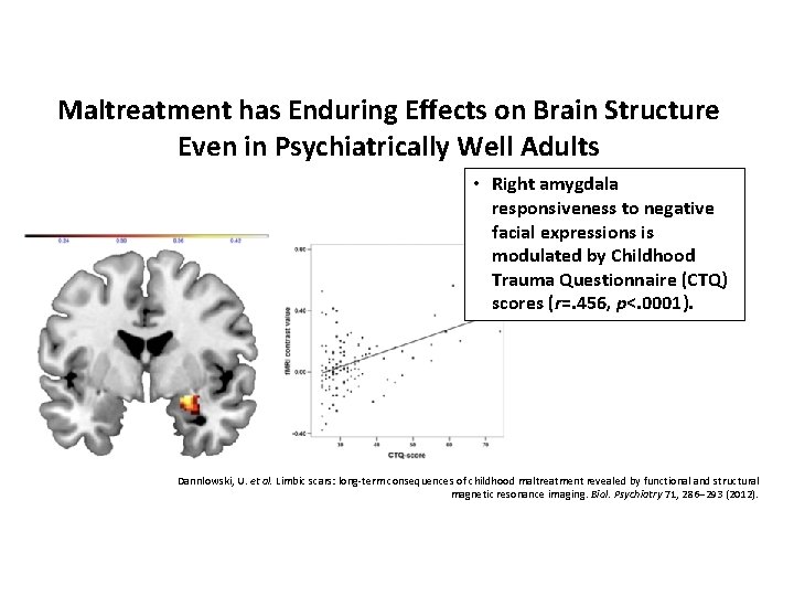 Maltreatment has Enduring Effects on Brain Structure Even in Psychiatrically Well Adults • Right