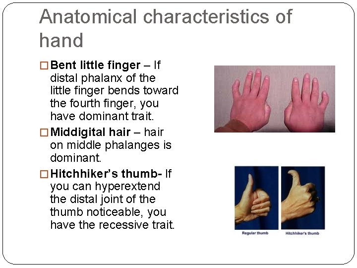 Anatomical characteristics of hand � Bent little finger – If distal phalanx of the