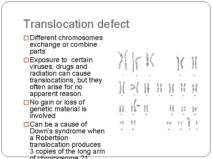 Translocation defect � Different chromosomes exchange or combine parts � Exposure to certain viruses,