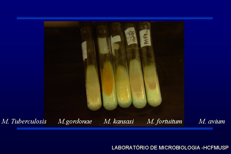 M. Tuberculosis M. gordonae M. kansasi M. fortuitum M. avium LABORATÓRIO DE MICROBIOLOGIA -HCFMUSP