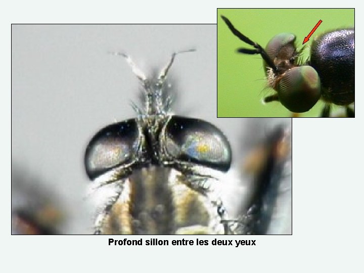 Profond sillon entre les deux yeux 