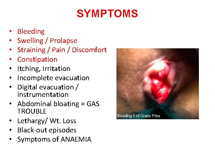 SYMPTOMS • • • Bleeding Swelling / Prolapse Straining / Pain / Discomfort Constipation