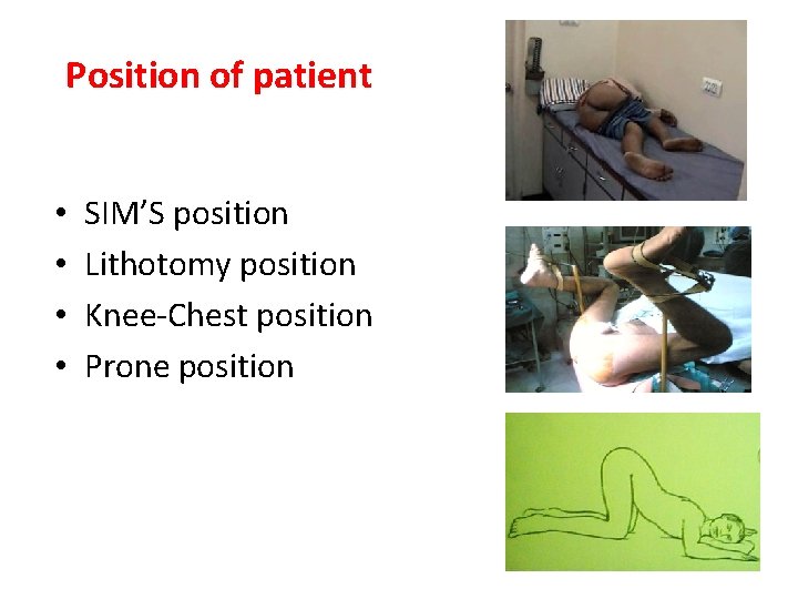 Position of patient • • SIM’S position Lithotomy position Knee-Chest position Prone position 