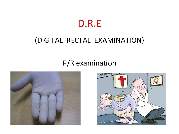 D. R. E (DIGITAL RECTAL EXAMINATION) P/R examination 