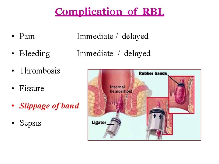 Complication of RBL • Pain Immediate / delayed • Bleeding Immediate / delayed •