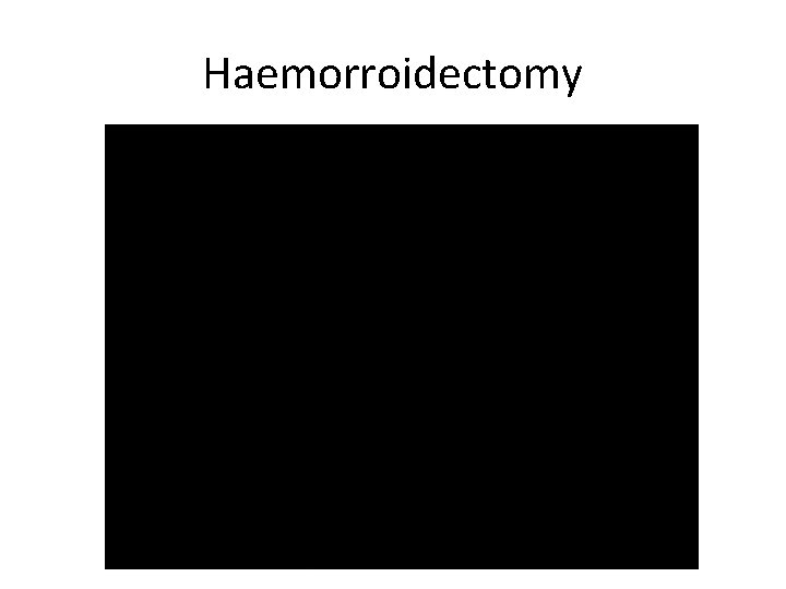 Haemorroidectomy 