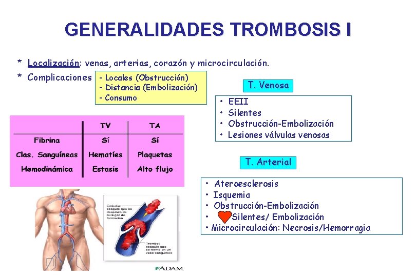 GENERALIDADES TROMBOSIS I * Localización: Localización venas, arterias, corazón y microcirculación. * Complicaciones -