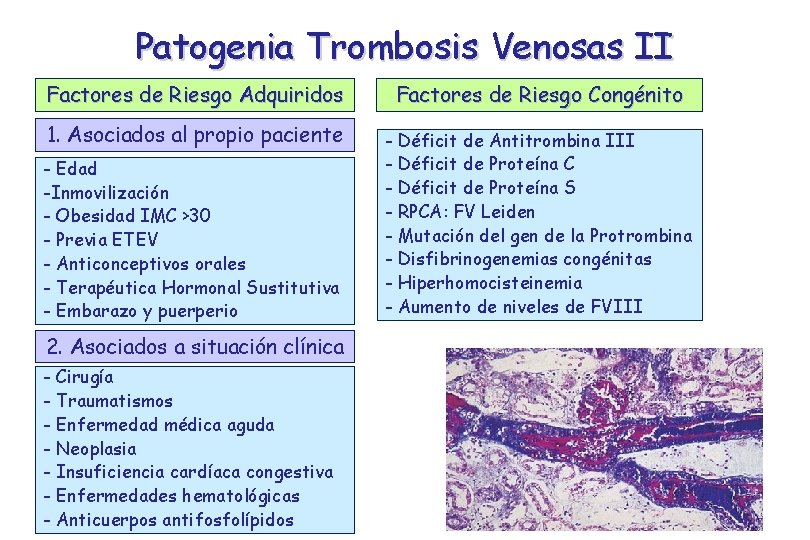 Patogenia Trombosis Venosas II Factores de Riesgo Adquiridos Factores de Riesgo Congénito 1. Asociados