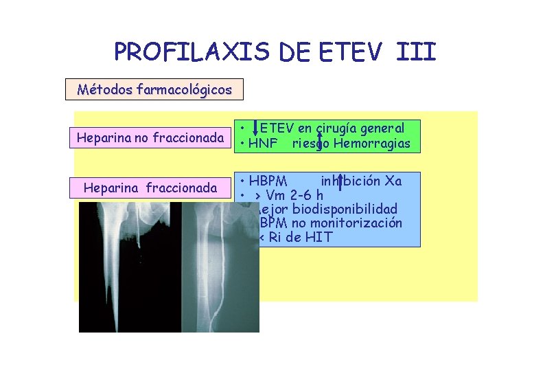 PROFILAXIS DE ETEV III Métodos farmacológicos Heparina no fraccionada Heparina fraccionada • ETEV en