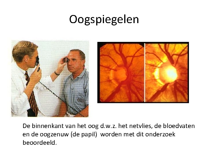 Oogspiegelen De binnenkant van het oog d. w. z. het netvlies, de bloedvaten en