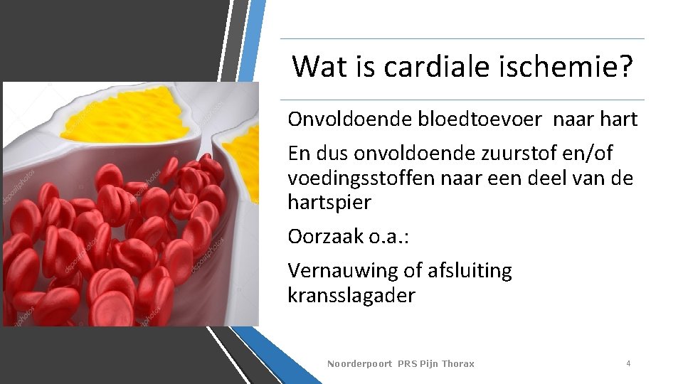 Wat is cardiale ischemie? Onvoldoende bloedtoevoer naar hart En dus onvoldoende zuurstof en/of voedingsstoffen